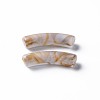 Two Tone Acrylic Beads LS-X-MACR-S272-78B-2